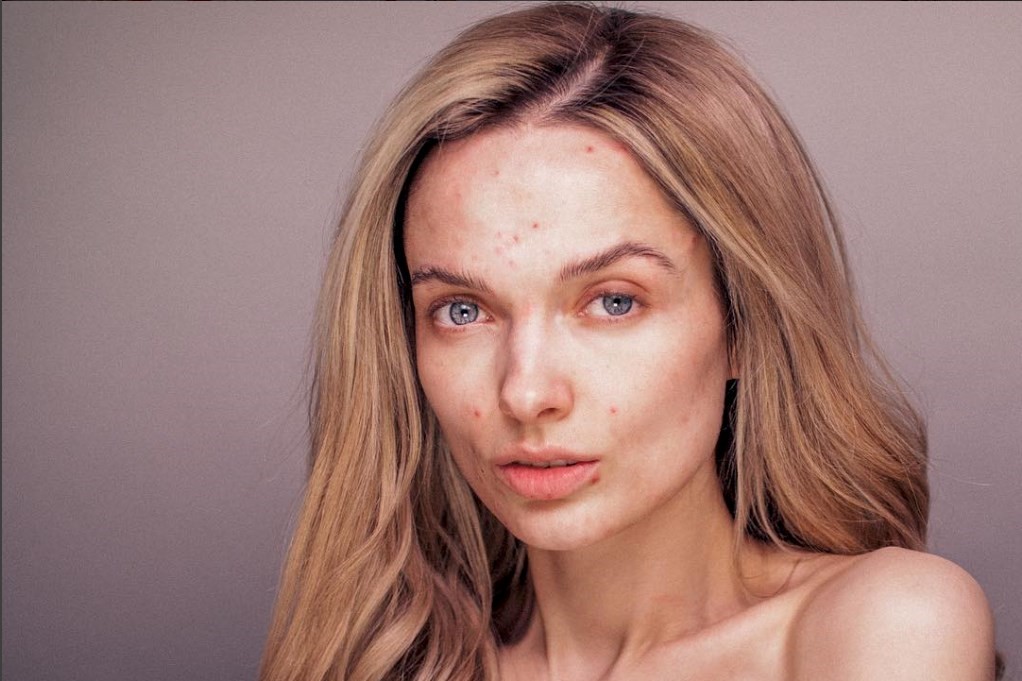 “you Look Disgusting” Beauty Blogger Releases Follow Up Video Dazed 