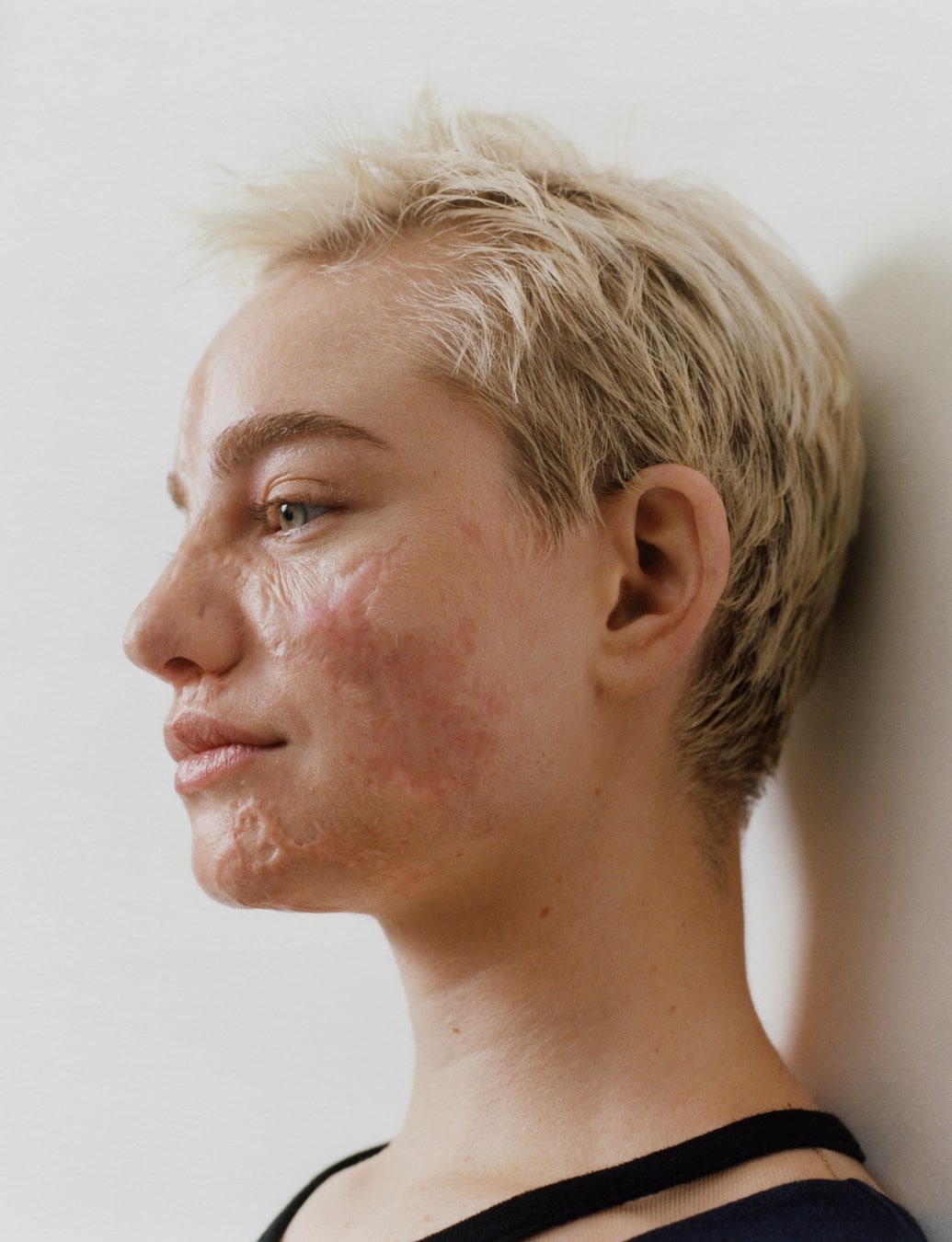 Bebe Vio, Dazed Summer 2024