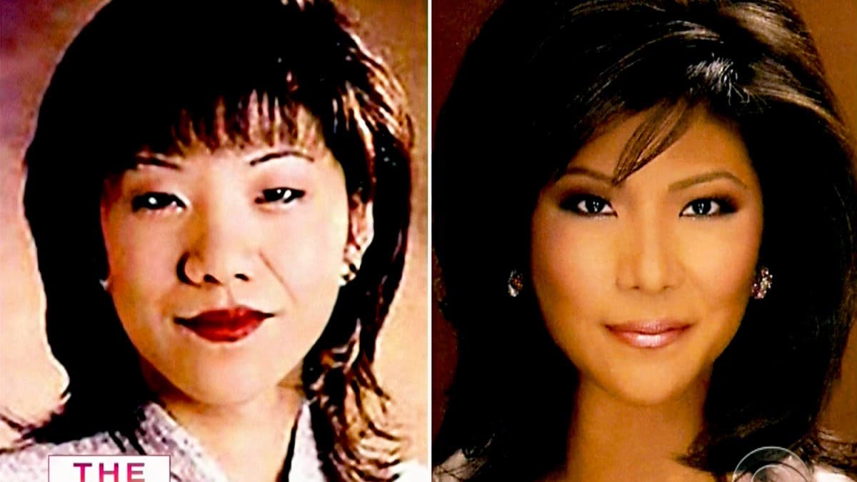 Why Is The Double Eyelid Surgery So Popular In Asia Dazed
