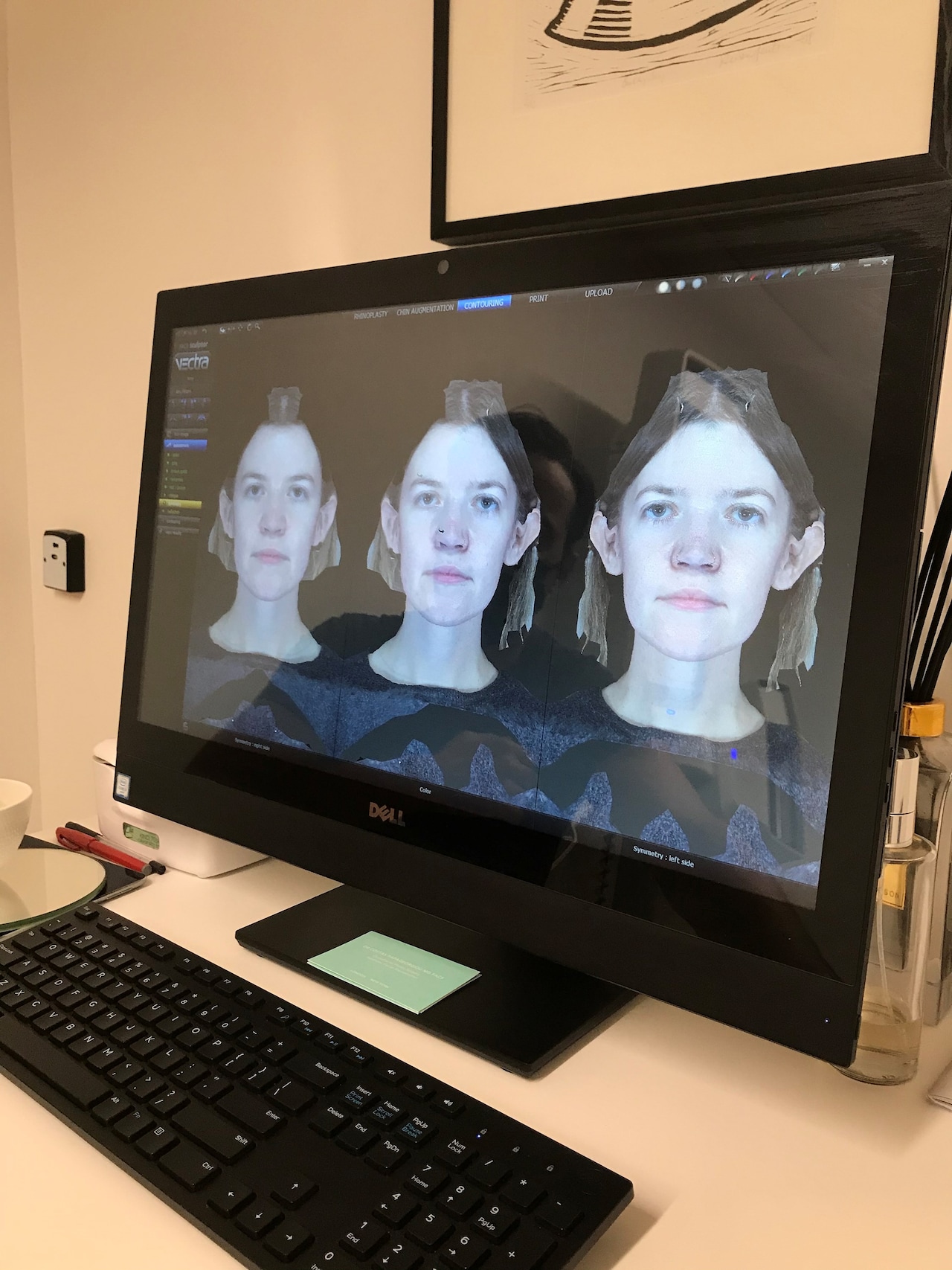 3d face scan treatment laser dr Costas Papageorgiou