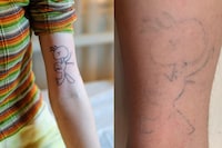 Ephemeral Tattoo made to fade two years later