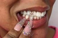 Tooth gems by Graciella Masterton 5
