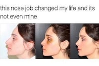 Before and After