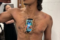 553587821_18078941057048772_1445087317746007381_n