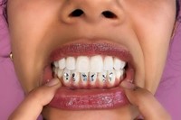 Tooth gems by Graciella Masterton 3