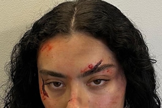 The Aestheticisation of Pain Within Beauty