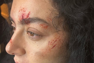 The Aestheticisation of Pain Within Beauty