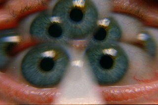 reel1_010122