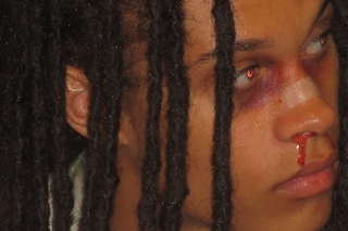 The Aestheticisation of Pain Within Beauty