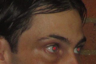 The Aestheticisation of Pain Within Beauty