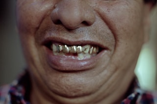 Juan Brenner, Tonatiuh Outtakes