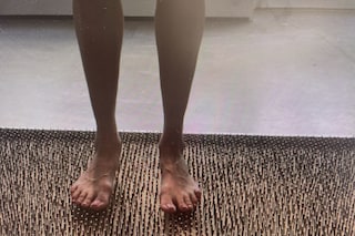 5b