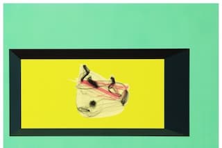 Albumen, Albumin, Albino, 2009