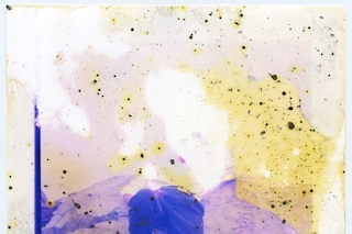 Untitled-4_Lunar-Caustic_MGTS