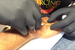 Inserting the microchip