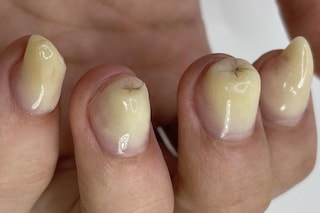 Grotesque rotten gross nails trend