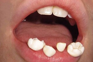 ig of the week gabbois