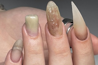 The rise of gross rotten grotesque nails
