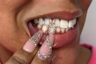 Tooth gems by Graciella Masterton