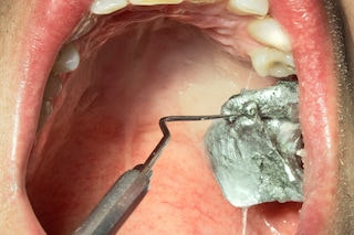 BODY HOLES by New Scenario
