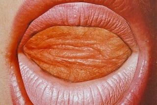 pennyslinger-readmylips