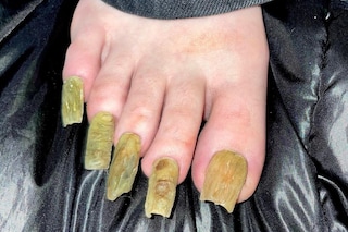 Grotesque rotten gross nails trend