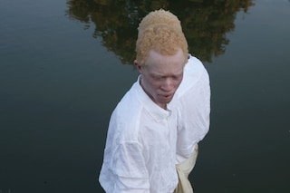 Albinism, photography Denisse Ariana P&#233;rez