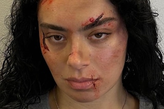 Pain aesthetic beauty Charli xcx