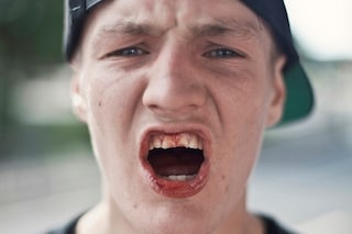 Richard Gilligan, DIY Skateparks, Dazed