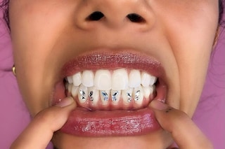 Tooth gems by Graciella Masterton