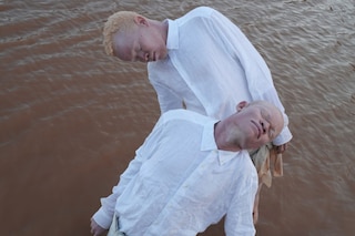 Albinism, photography Denisse Ariana P&#233;rez