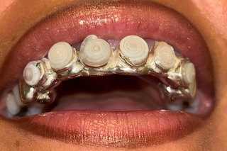 Vanessa Leon Mental Gardens