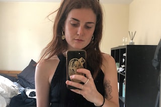 Brit Dawson laser tattoo removal