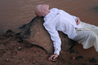 Albinism, photography Denisse Ariana P&#233;rez