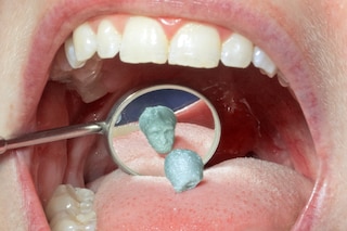 BODY HOLES by New Scenario