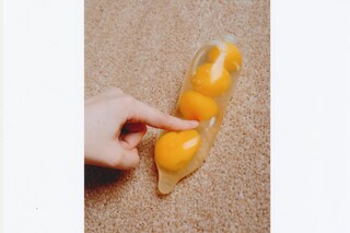 egg freezing fertility pregnancy 