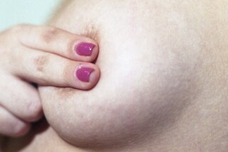 breast reduction pills 