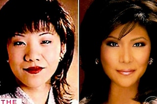 Julie Chen eyelid surgery