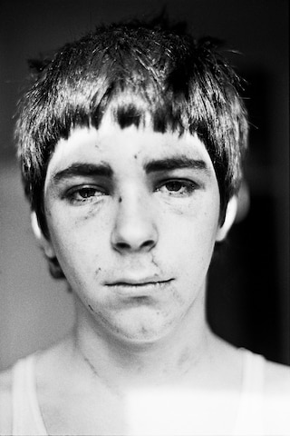 Smiler, Self Portrait after NF Beating, 1980 C-Pri