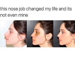 Before and After