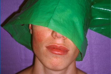 Walter Pfeiffer | Dazed