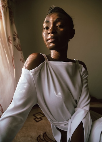 Kristin-Lee Moolman | Dazed