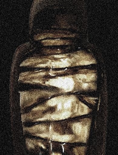 Mellified_man