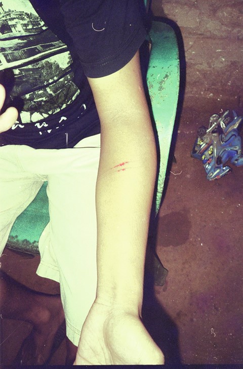 The arm of a man is slashed by a Madura dukun, yet