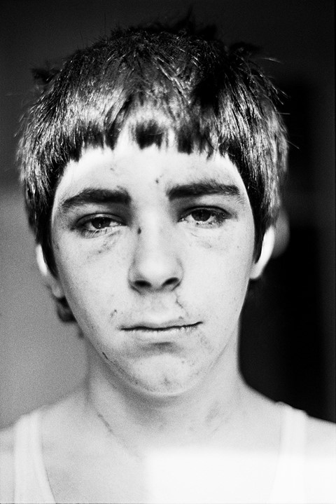 Smiler, Self Portrait after NF Beating, 1980 C-Pri