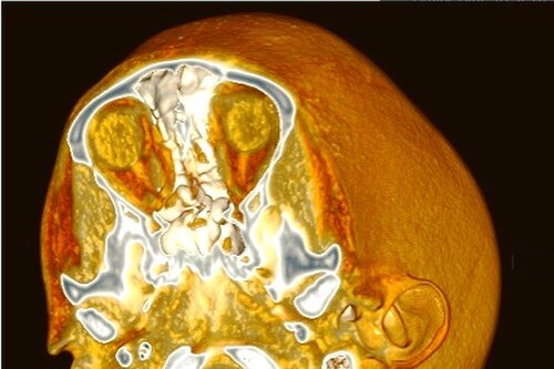 The beauty of… radiology imaging | Dazed