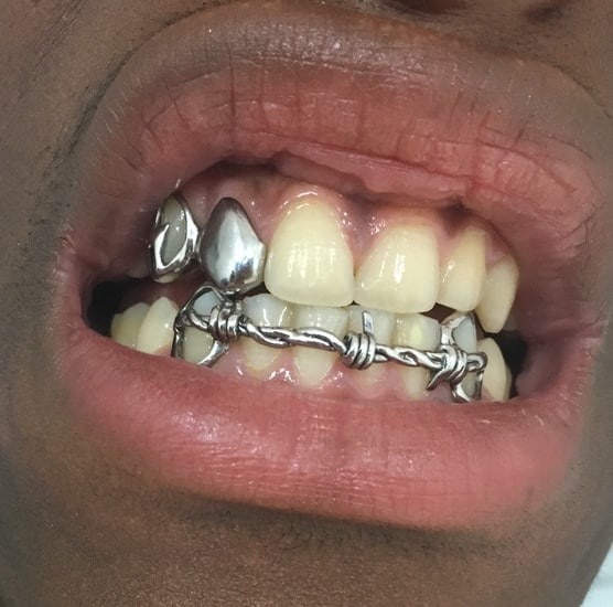 Lisa Michalik grills teeth makeup artist sfx 3