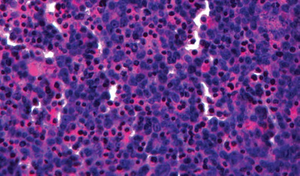 Cross-section of a bioprinted human liver
