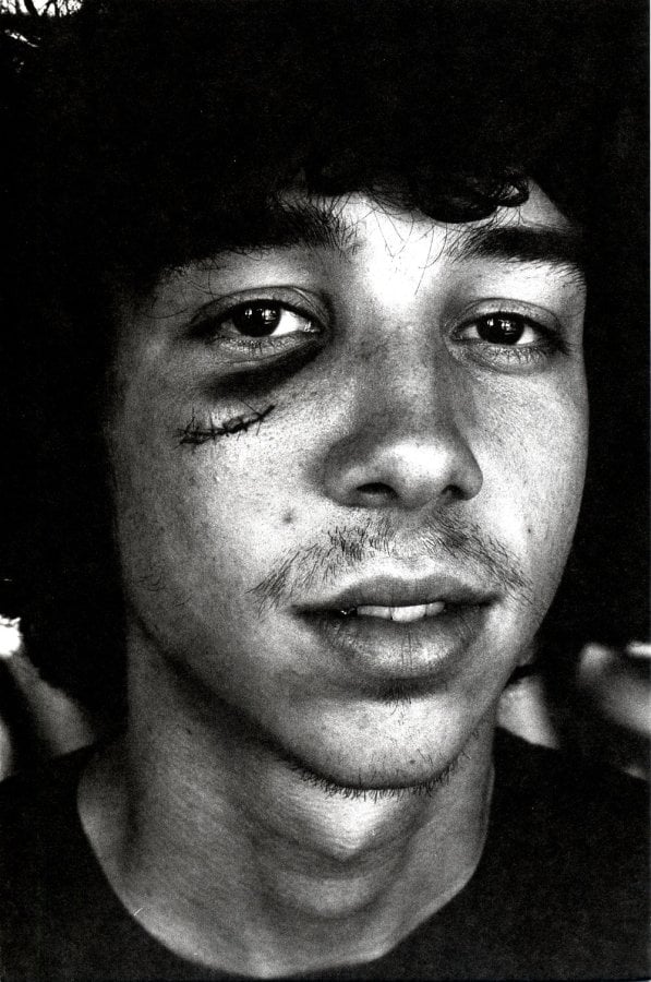 &quot;Kid with cut &amp; black eye&quot; by Ed Templeton 9