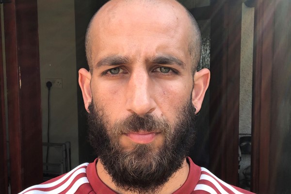 How to cope with going bald before you're ready to | Dazed How to cope with going bald before you're ready to | Dazed